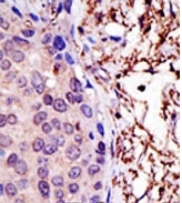 AP11976PU-N - UBE2L3 / UBCH7