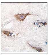 AP11992PU-N - UCHL1 / PGP9.5