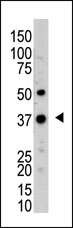 AP11996PU-N - UCHL5