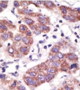 AP12006PU-N - USP3