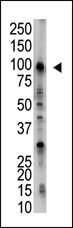 AP12012PU-N - USP5 / ISOT