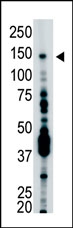 AP12016PU-N - USP7 / HAUSP