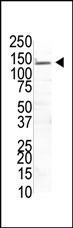 AP12018PU-N - USP8 / UBPY