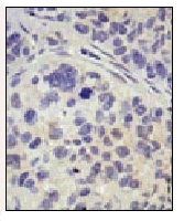 AP12018PU-N - USP8 / UBPY