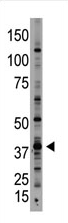 AP11940PU-N - GDF1