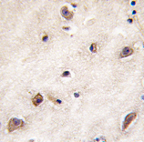 AP11940PU-N - GDF1