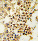 AP11943PU-N - GDF3