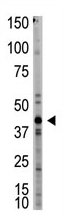 AP11945PU-N - Myostatin