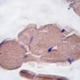 AP11945PU-N - Myostatin