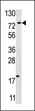 AP12034PU-N - USP16