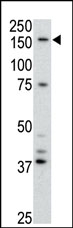 AP13075PU-N - ABCB4 / MDR3