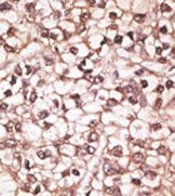 AP13075PU-N - ABCB4 / MDR3