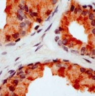 AP15548PU-S - CD178 / Fas Ligand