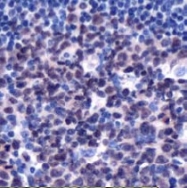 AM11170PU-S - Rhombotin-2