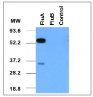 AM08181PU-N - Influenza A