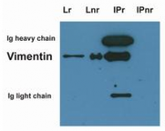 SM3166P - Vimentin