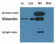 SM3128P - Vimentin