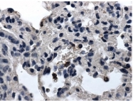 DM3536P - CD103