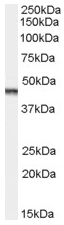 AP15874PU-N - Aurora kinase A