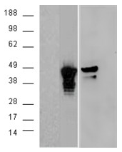 AP15874PU-N - Aurora kinase A