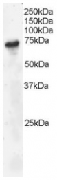 AP15895PU-N - B-cell linker protein / BLNK