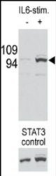 AP11566PU-N - STAT3
