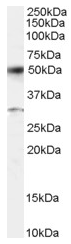 AP15925PU-N - ATF2