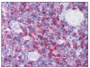 AP08153PU-N - CD8