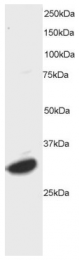 AP15939PU-N - ATF7