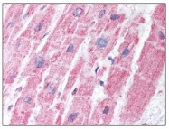 AP08209PU-N - MDH1