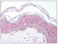 AP08209PU-N - MDH1