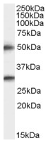 AP15980PU-N - TMPRSS5 / Spinesin