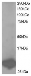 AP15998PU-N - BCAP31 / BAP31
