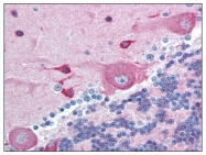 AP08269PU-N - PACSIN2