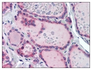 AP08270PU-N - TRHR