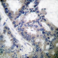 AP06181PU-N - NOS2