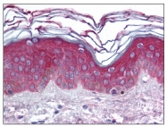 AP08283PU-N - ARHGEF11