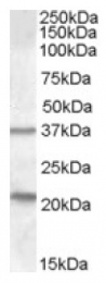 AP17067PU-N - TUSC3 / N33