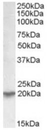 AP17068PU-N - UXT / HSPC024
