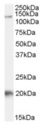 AP17014PU-N - HIV Tat-specific factor 1 / HTATSF1