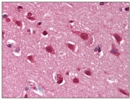 AP08309PU-N - Dynamin-1
