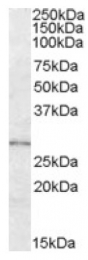 AP17018PU-N - LYPLAL1