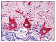 AP08316PU-N - SLC15A1 / PEPT1