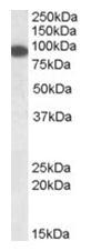 AP16082PU-N - ERC1 / ELKS