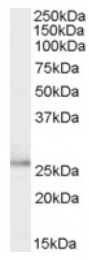 AP17062PU-N - Tumor protein D53 (TPD52L1)