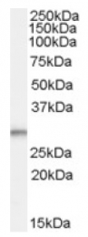 AP17063PU-N - Tumor protein D54 (TPD52L2)