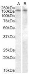 AP16951PU-N - Vasopressin V1b receptor (V1bR)