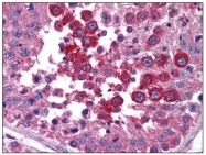 AP08356PU-N - STAT4