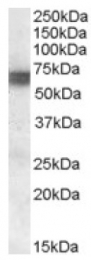 AP16981PU-N - BIN1 / AMPHL