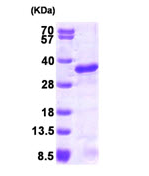 AR09255PU-L - UBE2S